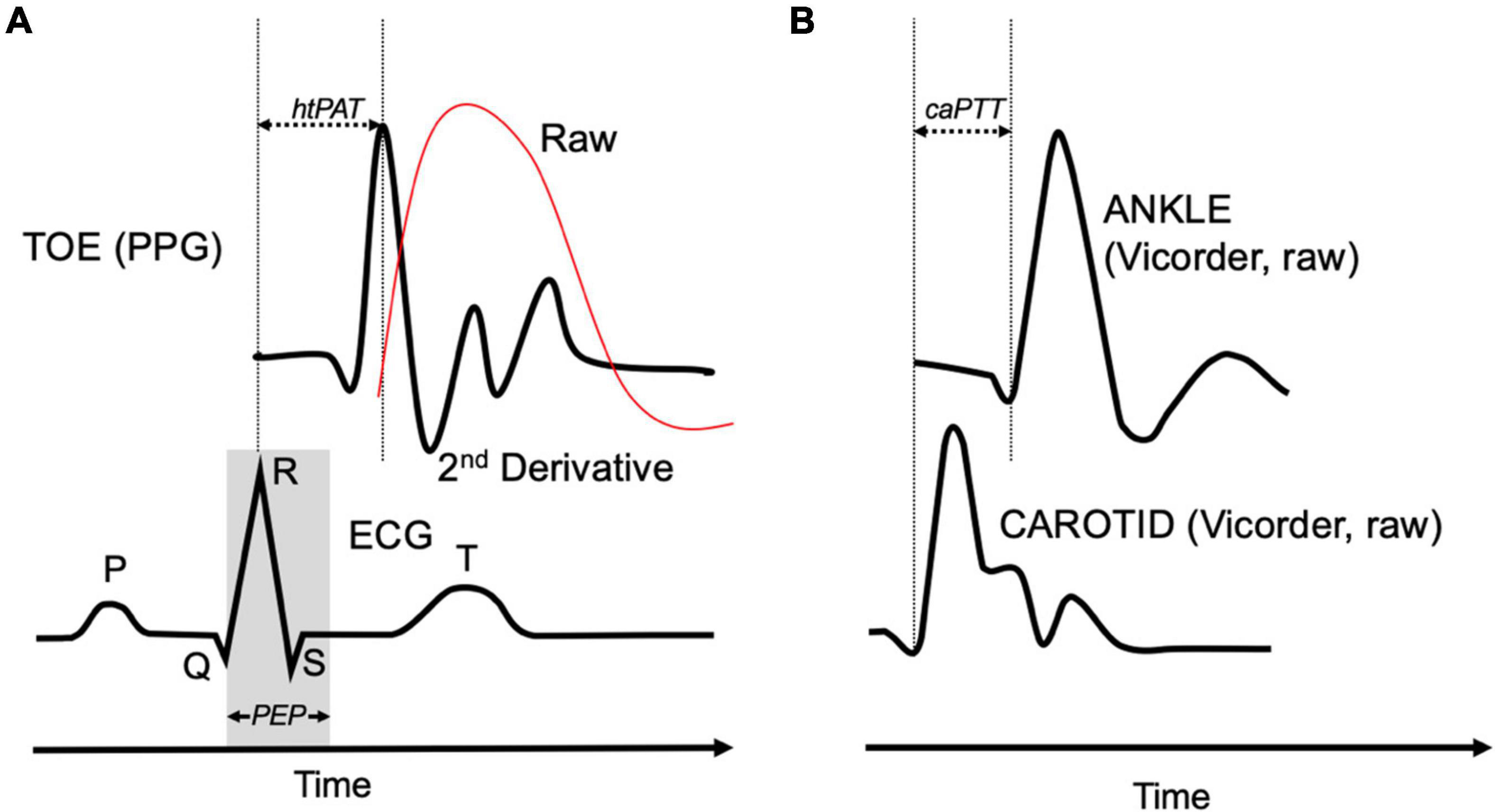 Frontiers Pulse wave Velocity Assessments Derived From A Simple frontiers-pulse-wave-velocity-assessments-derived-from-a-simple